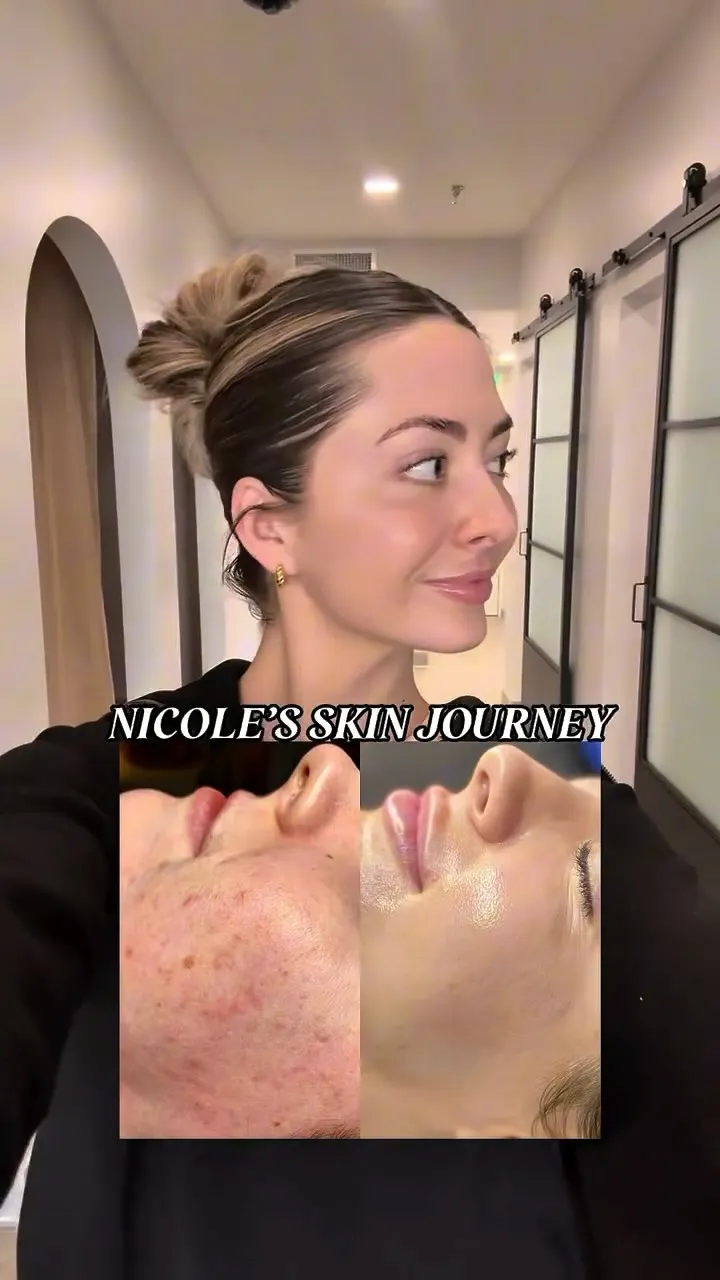 A Nakie Face skincare journey